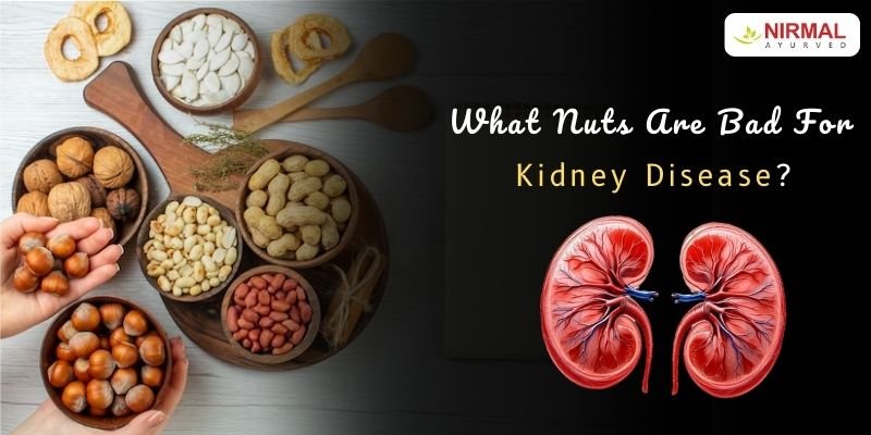What nuts are bad for kidney disease – high phosphorus and high potassium nuts compared with kidney friendly options
