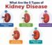 what are the 5 types of kidney disease